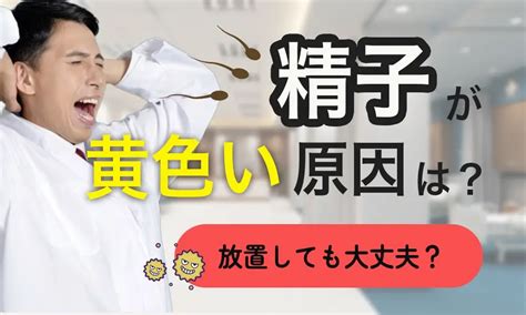 精子が黄色いのは病気？精液検査を受けるべきケース。